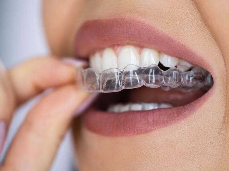 Protocolo sobre implantes